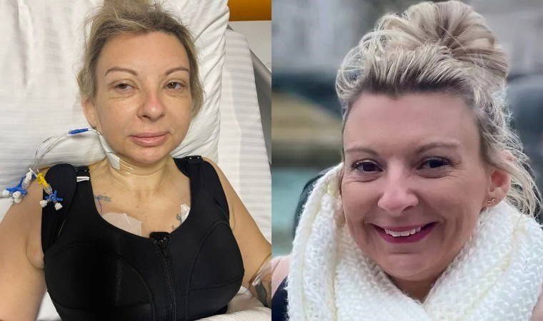 İngiliz kadının Türkiye'deki estetik kâbusu