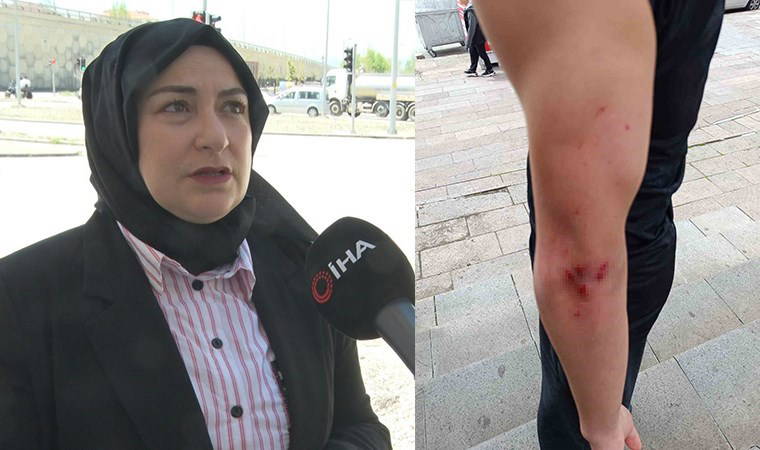 Ankara'da 14 yaşındaki çocuğa öldüresiye 'darp' iddiası: 'Evladım beyin tümörüyle mücadele ediyor...'