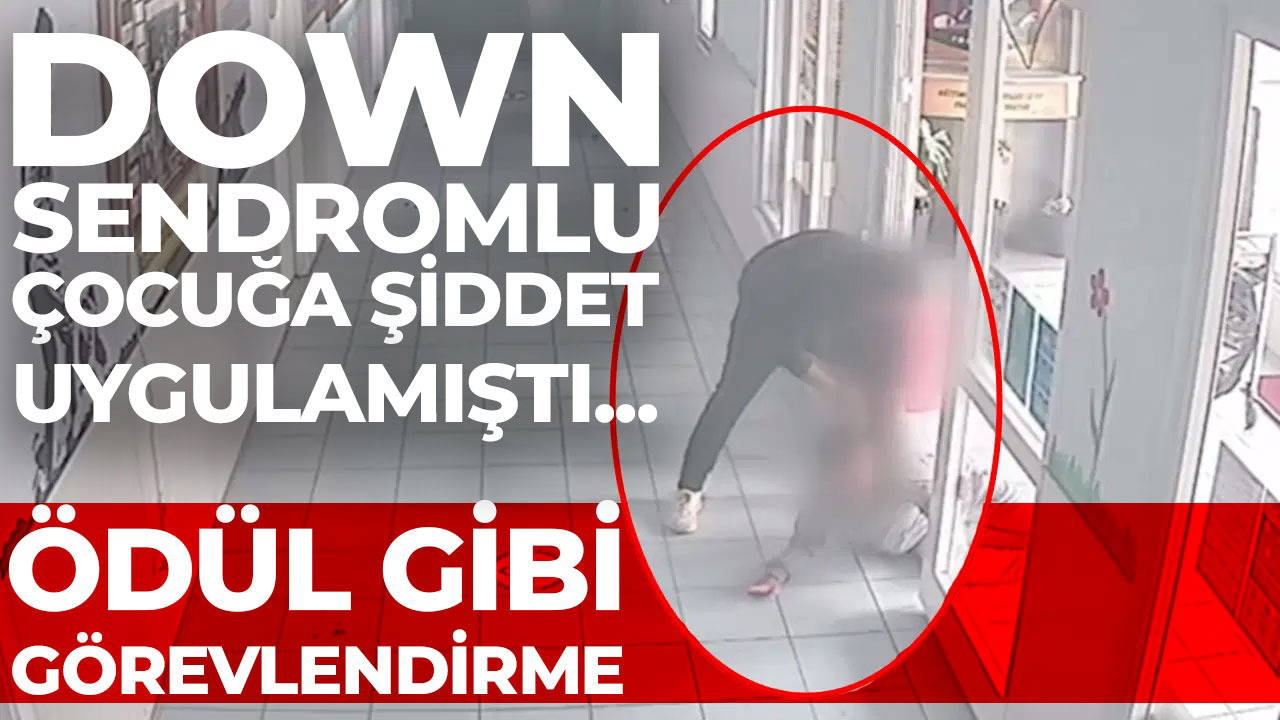 Down sendromlu çocuğa şiddet