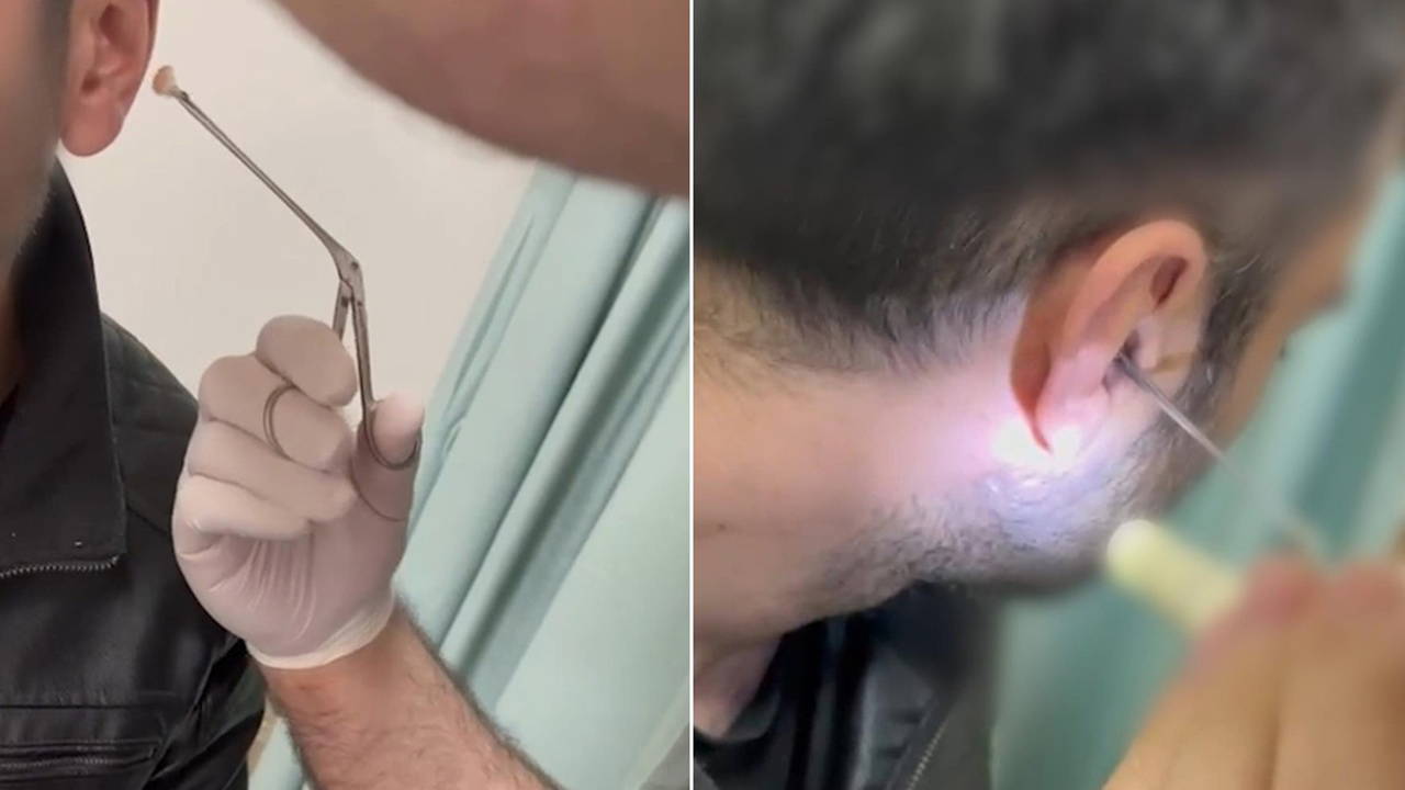 Kulağının içine uyuşturucu saklayan şüpheli yakalandı