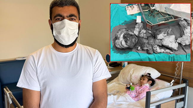Tıp dünyasını şaşırtan ameliyat: Boynundan 3 kiloluk kitle çıkarıldı!