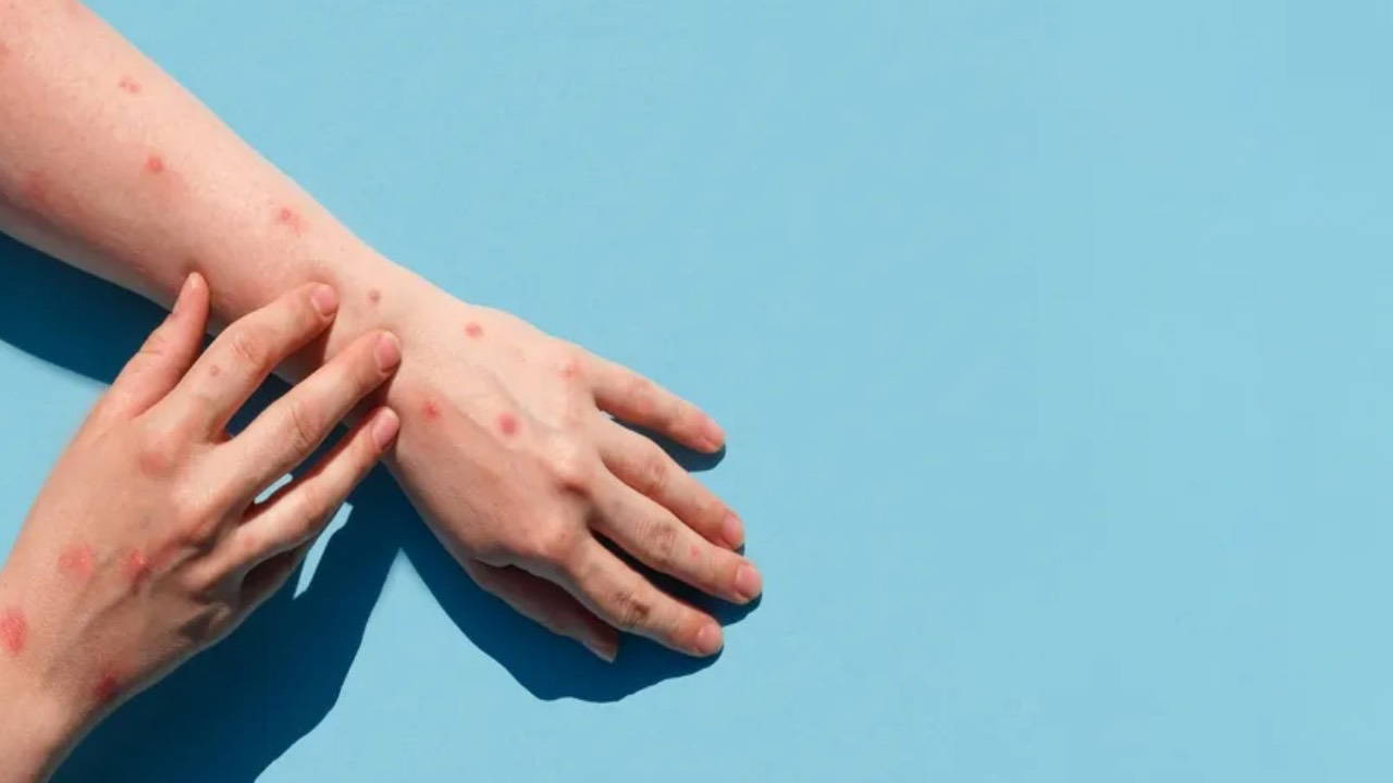 Bangladeş'te dang humması nedeniyle son 24 saatte 3 kişi öldü