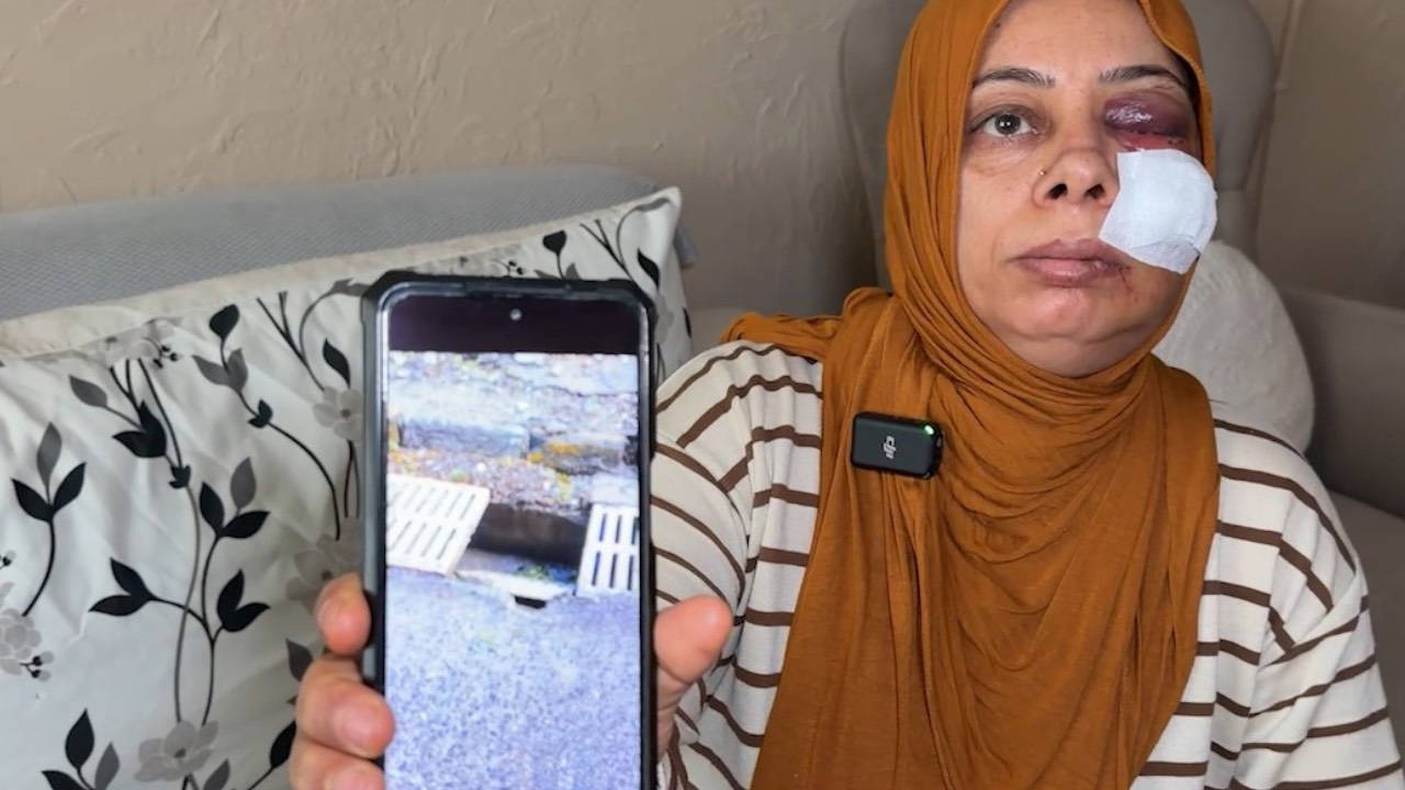 Elektrikli bisikleti ile kapağı kırık rögara düştü: Yüzüne 14 dikiş atıldı