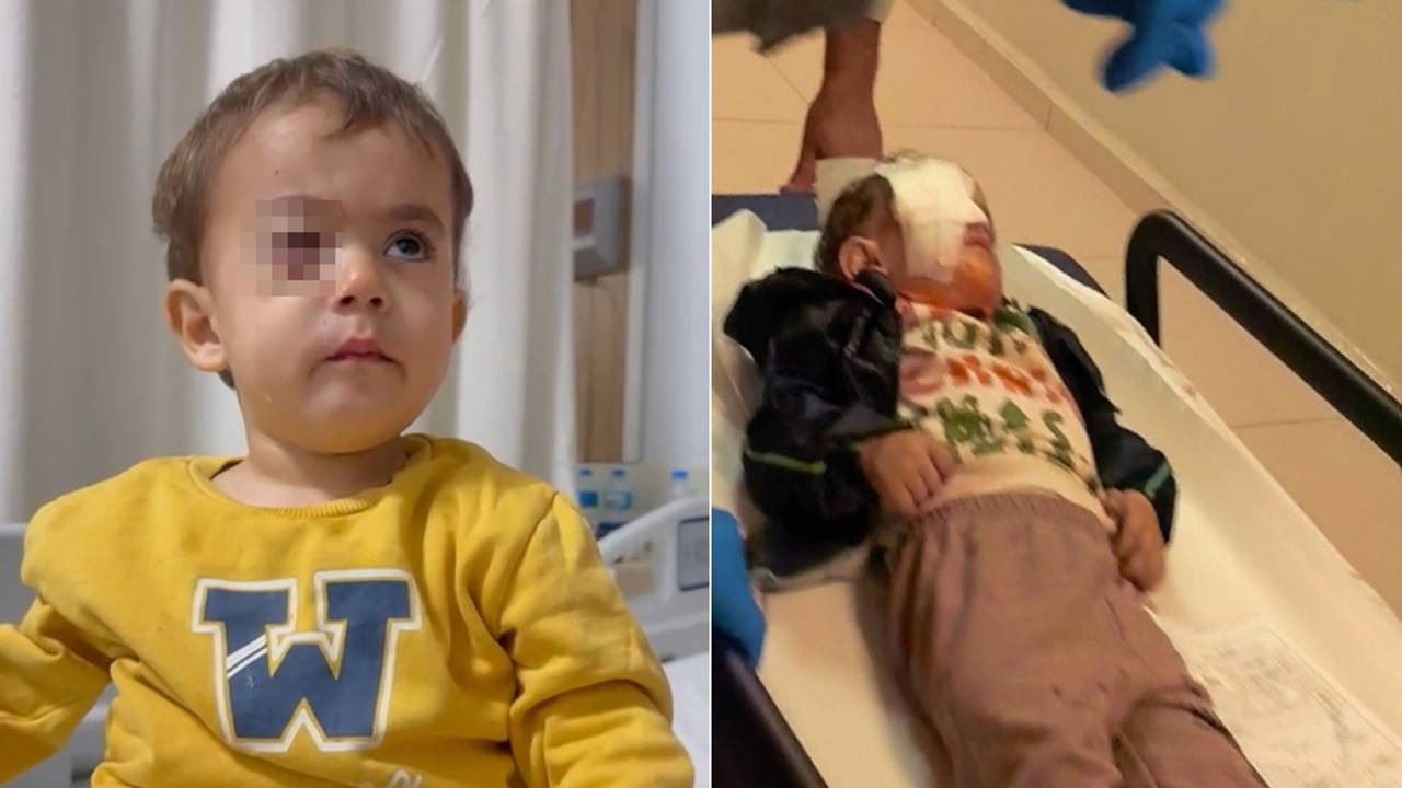 Baba, fırıncıyı daha önce uyarmış! 2 yaşındaki Alpaslan gözünü kaybetti