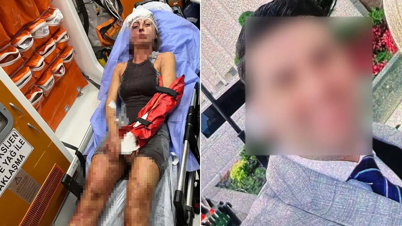Uzaklaştırma kararı aldıran kadına dehşeti yaşattı: Sopayla darbetti, ellerini kırdı!