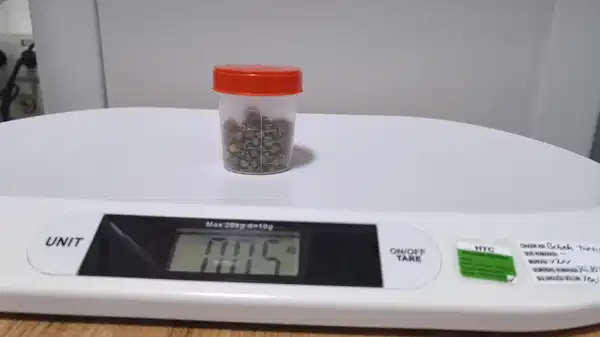 Bursa'da 77 yaşındaki kadının safra kesesinden 213 tane taş çıkarıldı