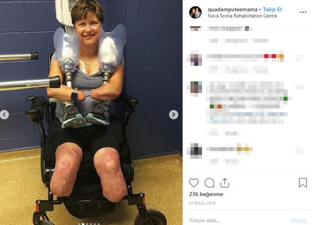 Doğumda kaptı! Vücudunu yemeye başladı