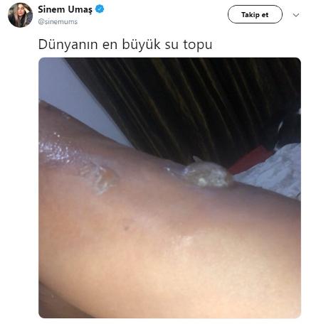 Vücudu yanan Sinem Umaş isyan etti: Ata benim yüzümden mi öldü?