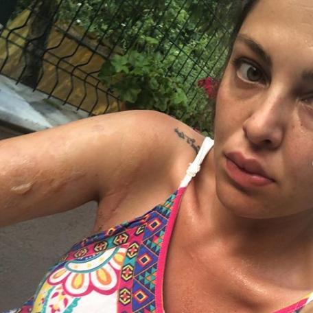 Vücudu yanan Sinem Umaş isyan etti: Ata benim yüzümden mi öldü?