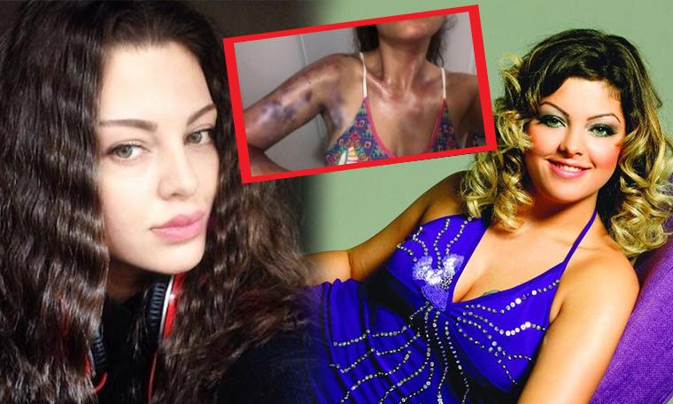 Vücudu yanan Sinem Umaş isyan etti: Ata benim yüzümden mi öldü?