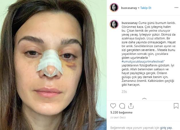 CNN Türk spikeri Büşra Sanay kaza geçirdi