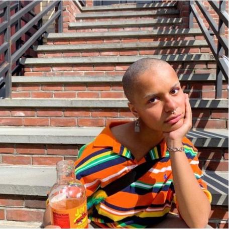 Sosyal medya fenomeni dakikalar içinde kel kaldı!