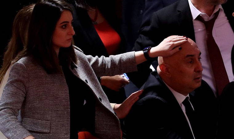 Meclis'teki kavga sonrası Özkoç’un yüzünde ve kafasında şişlik oluştu!