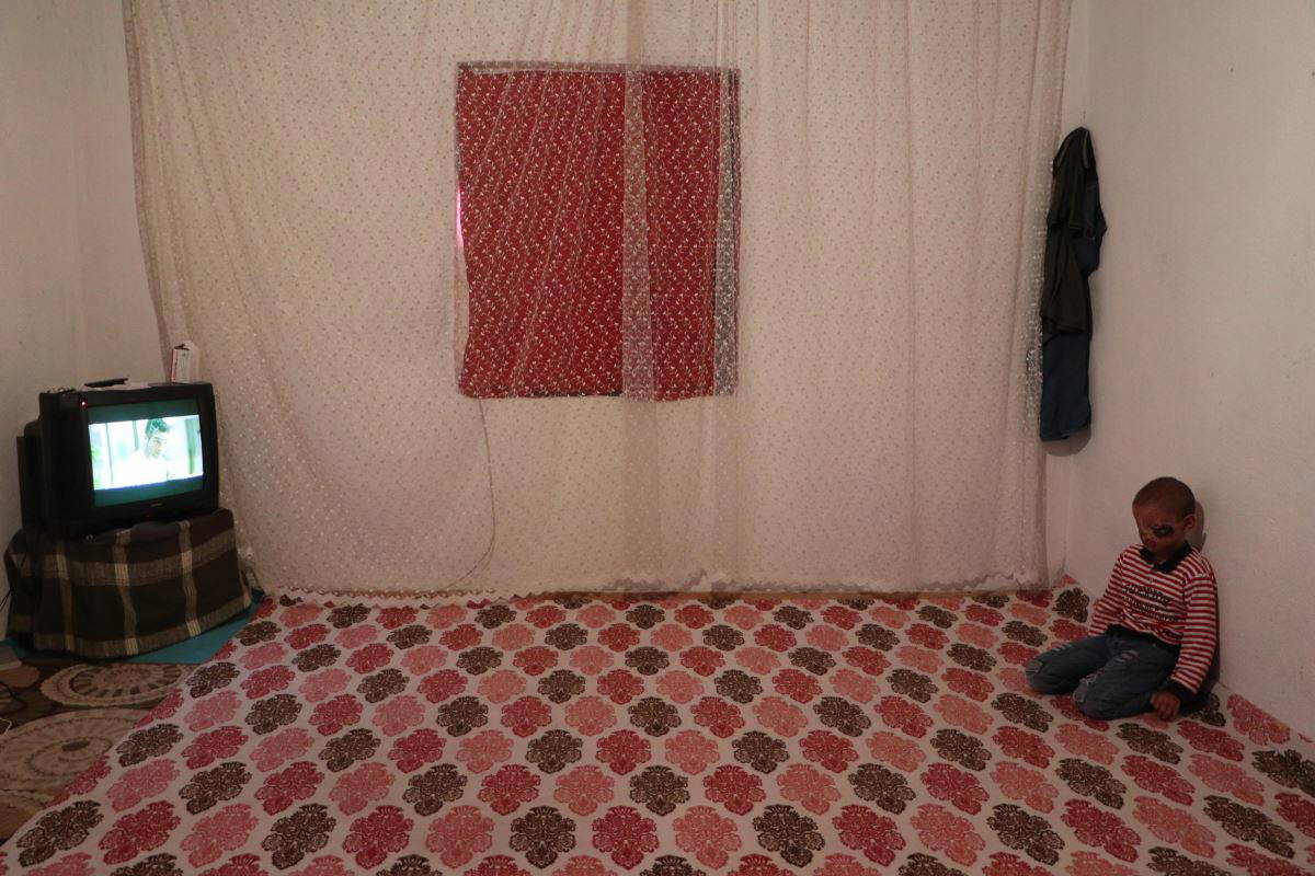 Cilt kanseri henüz 8 yaşında, gün ışığına çıkamıyor...  