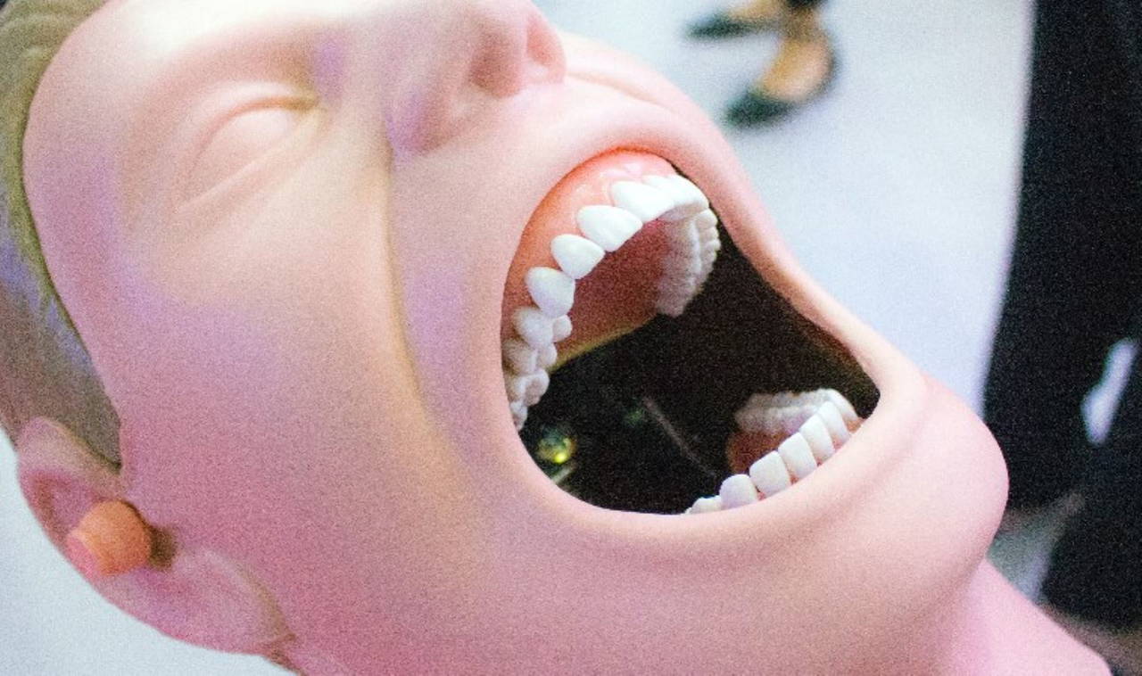 Bruksizm (Diş Sıkması) nedir, sebepleri neler, nasıl tedavi edilir?