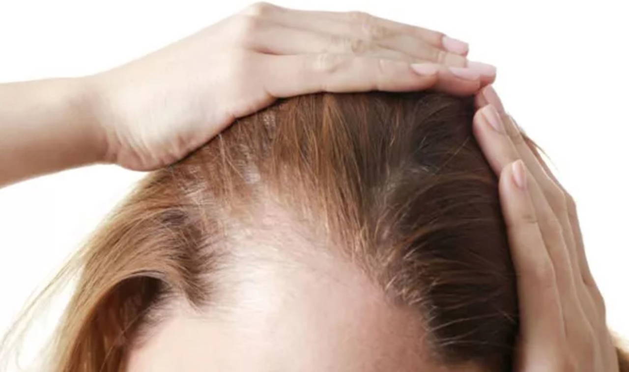 Cilt sağlığını bozuyor, erken yaşlanmaya sebep oluyor: Stresin sebep olduğu 6 cilt hastalığı