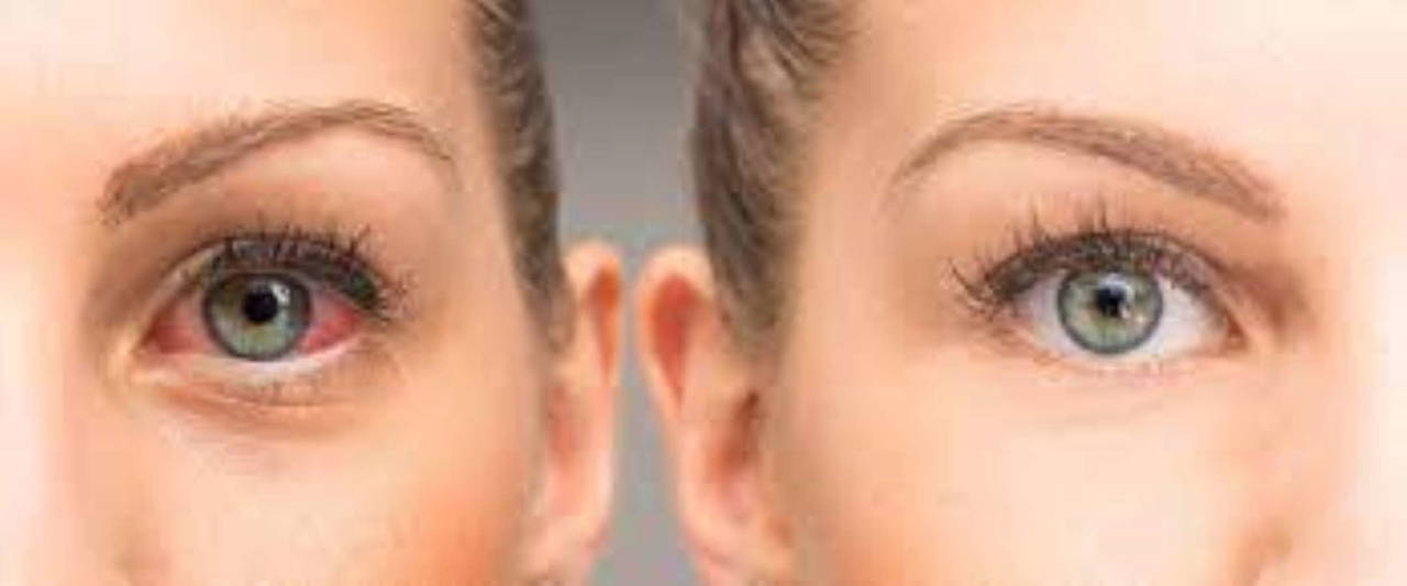 Göz kuruluğuna son veriyor, katarakt oluşumunun önüne geçiyor: Göz sağlığına iyi gelen 10 süper besin