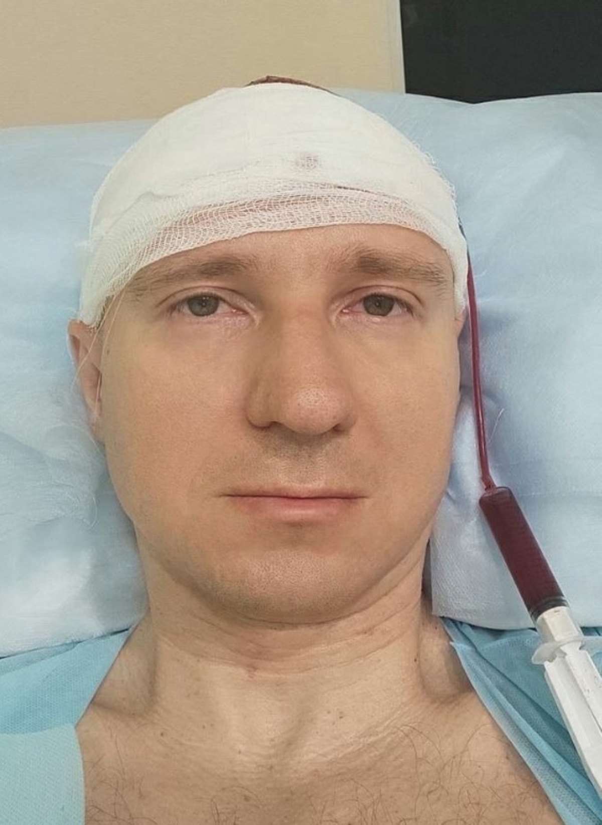 Rüyalarını kontrol edebilmek için kafasını matkapla deldi