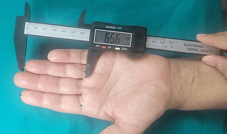 'Yüzük parmağı, işaret parmağından uzunsa...' Bilim insanlarından çarpıcı keşif!