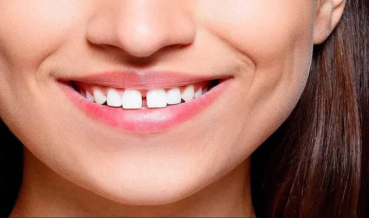 İnsanların çok azında olan fiziksel özellikler: Siz de farklı olabilirsiniz