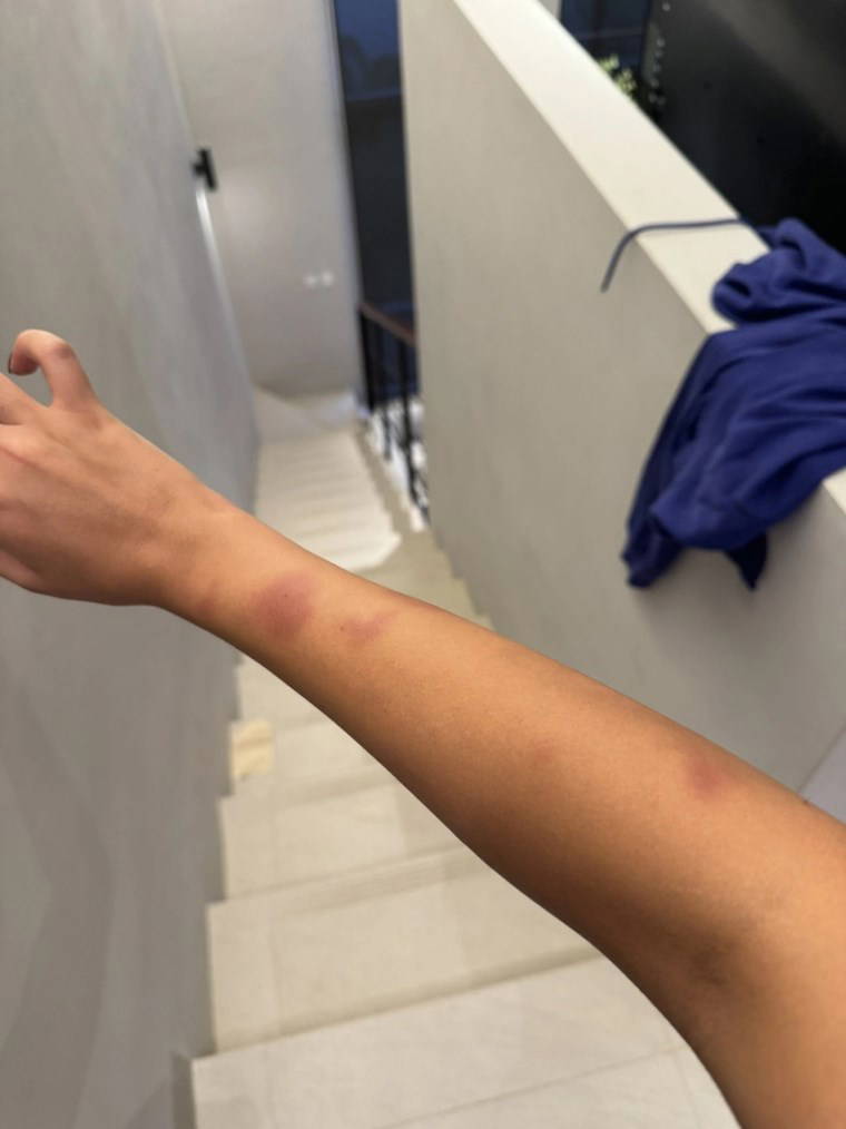 Merve Taşkın yaşadığı korkunç şiddeti paylaştı: 'Karnıma, cinsel organıma tekme atıyordu'