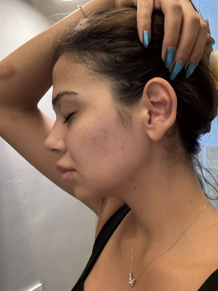 Merve Taşkın yaşadığı korkunç şiddeti paylaştı: 'Karnıma, cinsel organıma tekme atıyordu'