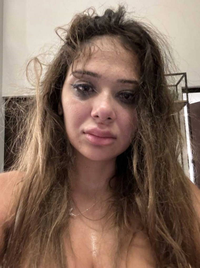 Merve Taşkın yaşadığı korkunç şiddeti paylaştı: 'Karnıma, cinsel organıma tekme atıyordu'