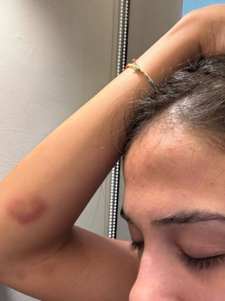 Merve Taşkın yaşadığı korkunç şiddeti paylaştı: 'Karnıma, cinsel organıma tekme atıyordu'