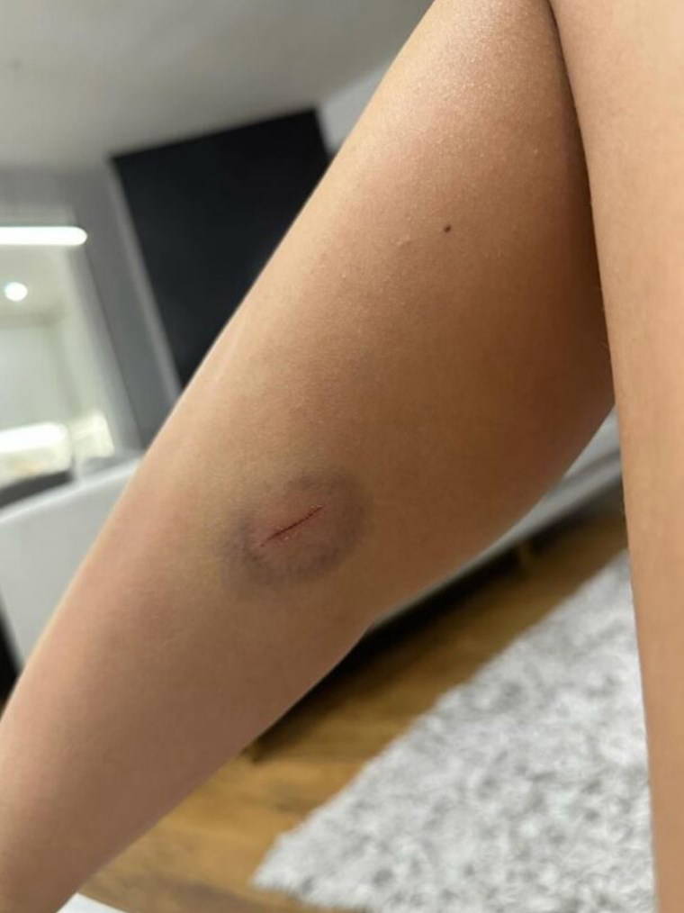 Merve Taşkın yaşadığı korkunç şiddeti paylaştı: 'Karnıma, cinsel organıma tekme atıyordu'