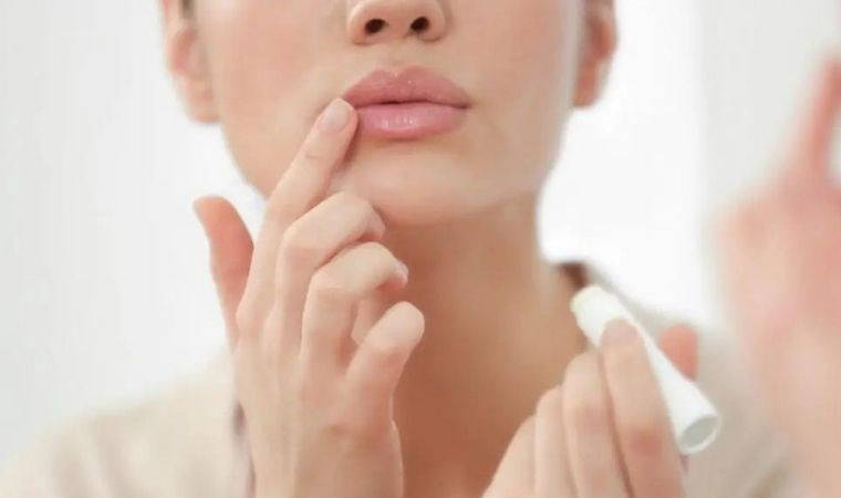 Dudak kuruluğuna son veriyor, çatlakları anında iyileştiriyor: Kış aylarında dudak bakımında kullanabileceğiniz 6 doğal ürün