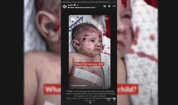 Hadise İsrail'in saldırılarına tepki gösterdi: 'Var olmayan insanlıktan iğrendiğiniz an budur'