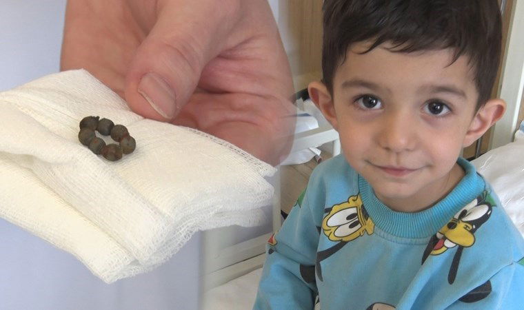 Ankara'da doktorları şaşırtan vaka: 3 yaşındaki çocuğun bağırsağından çıktı...