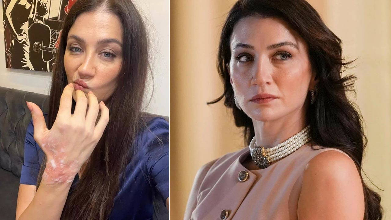 Eşref Rüya dizisinin setinde korkutan kaza: Ceren Benderlioğlu hastanelik oldu!