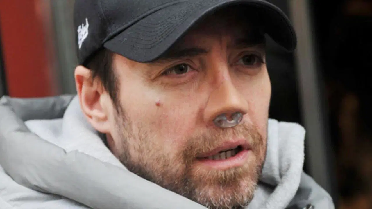 Burun kemiklerim dışarı çıkıyor demişti: Murat Dalkılıç 13. kez ameliyat masasında