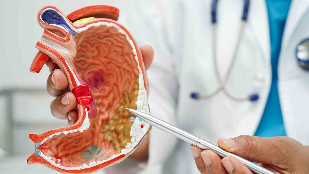 Gece mide yanması yaşayanlar dikkat: Ciddi hastalıkların habercisi olabilir!