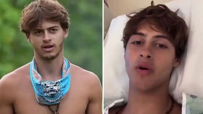 Bacağı ampute edilen Survivor yarışmacısından ilk mesaj geldi!