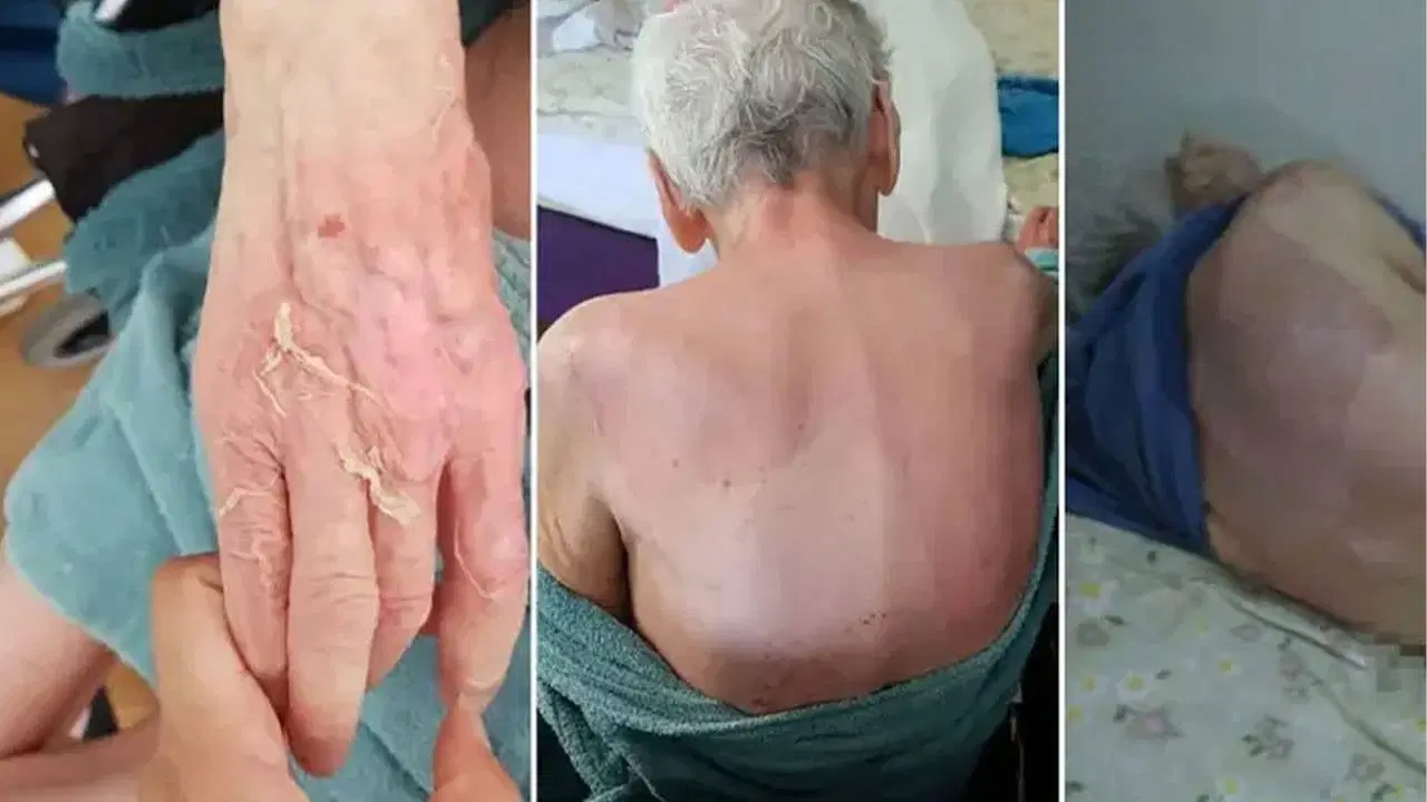 Yaşlı Kadının Ölümündeki Skandala 21 Bin Lira Ceza mı?