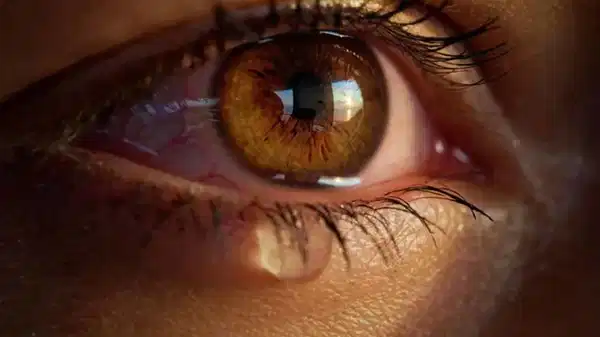 İnsan gözyaşının bilimsel açıklaması: Neden ağlarız?