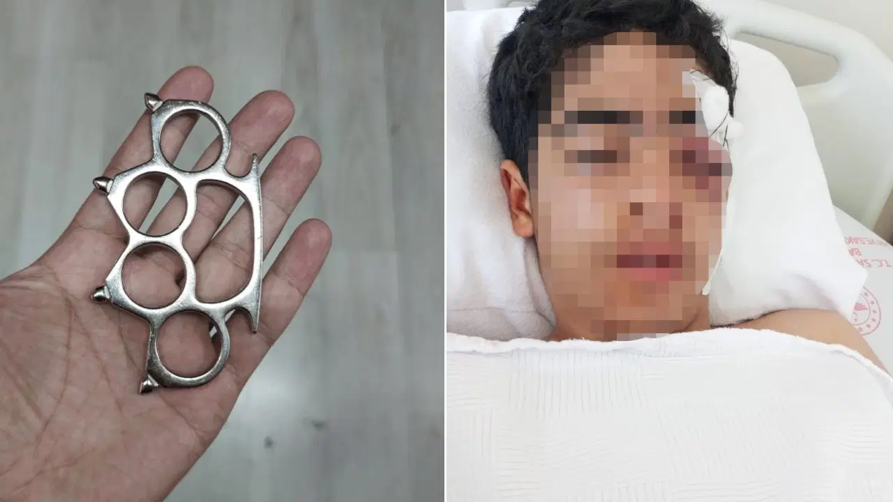 Bu kez adres İstanbul Esenyurt... 15 yaşındaki çocuğa akranından muştalı saldırı: Vücudunda çok sayıda kırık var!