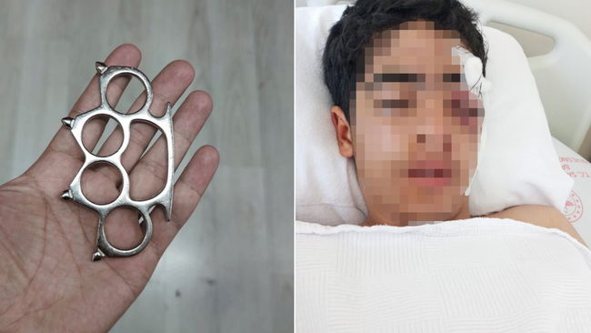 Vücudunda çok sayıda kırık var!