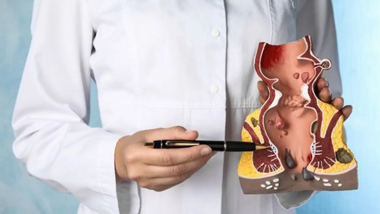 'Hemoroid birçok ciddi hastalıkla karışabiliyor'