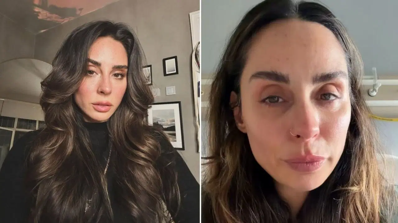 Hepsi grubunun eski üyesi Yasemin Yürük’ten korkutan haber: Ameliyat edildi, platin takıldı!