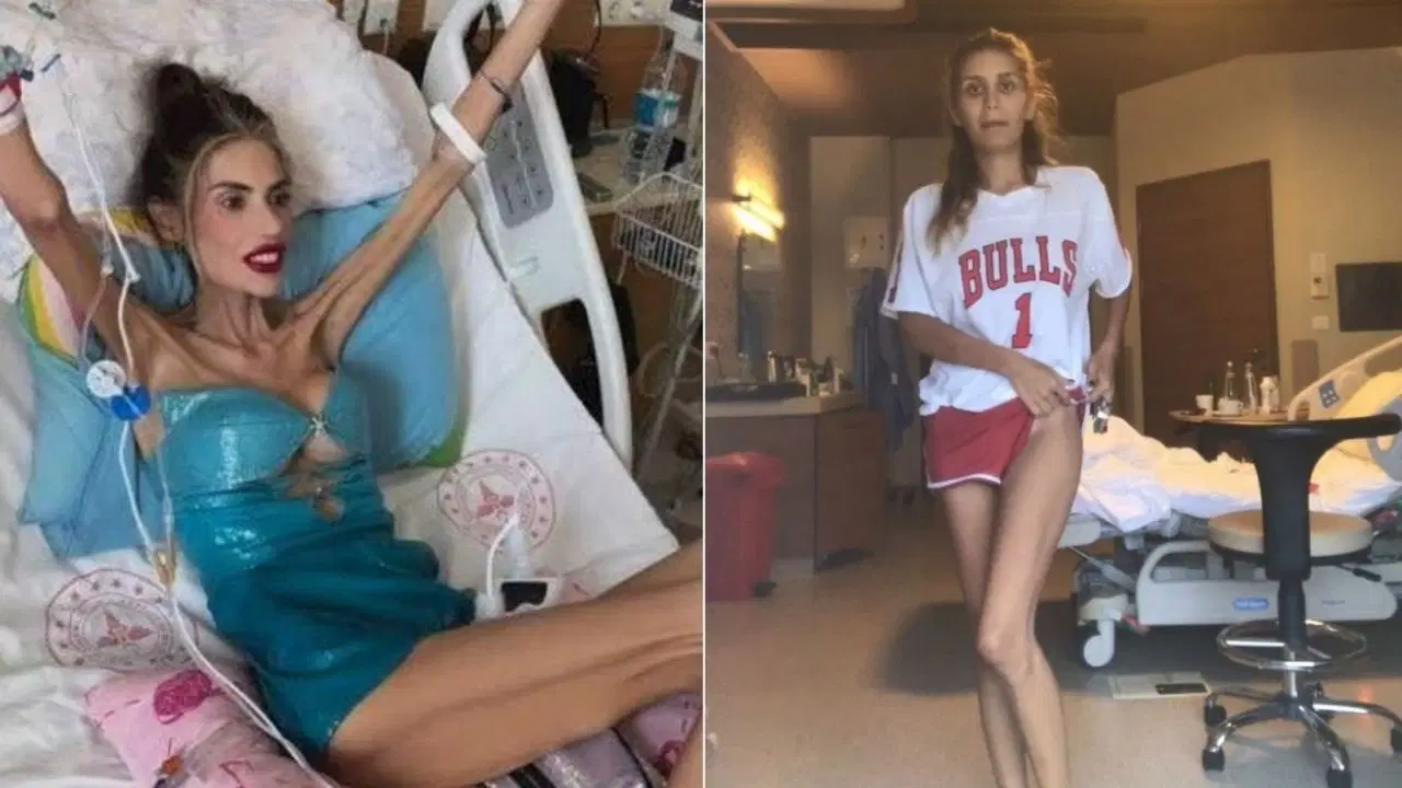 İrem Derci'de aynı hastalığı yaşamıştı: Nihal Candan'ın ardından o zamanları paylaştı