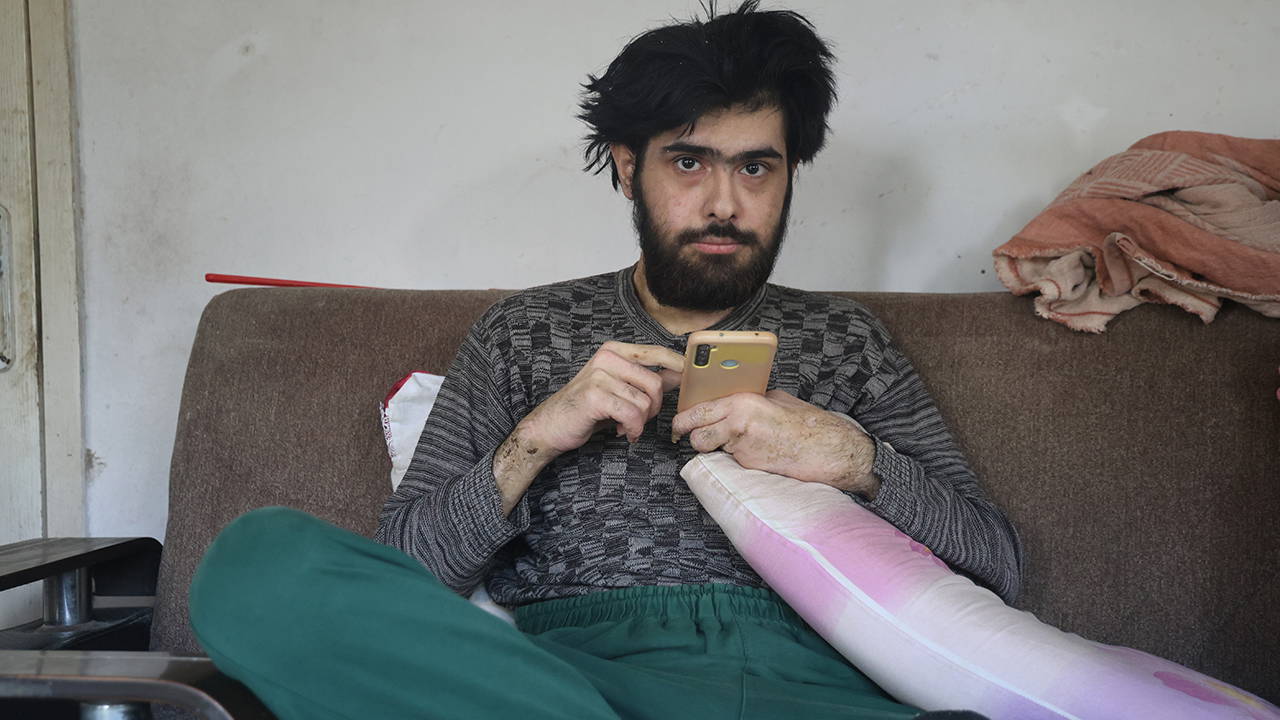  Telefon bağımlısı genç ne duş alıyor ne de tırnaklarını kesiyor!