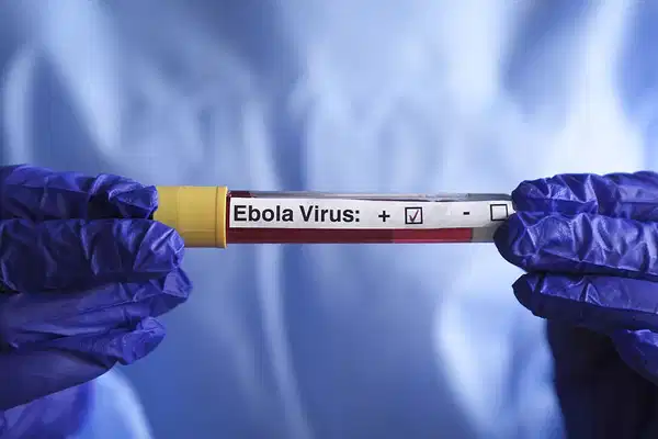 Fransa’da ilk Ebola vakası tespit edildi