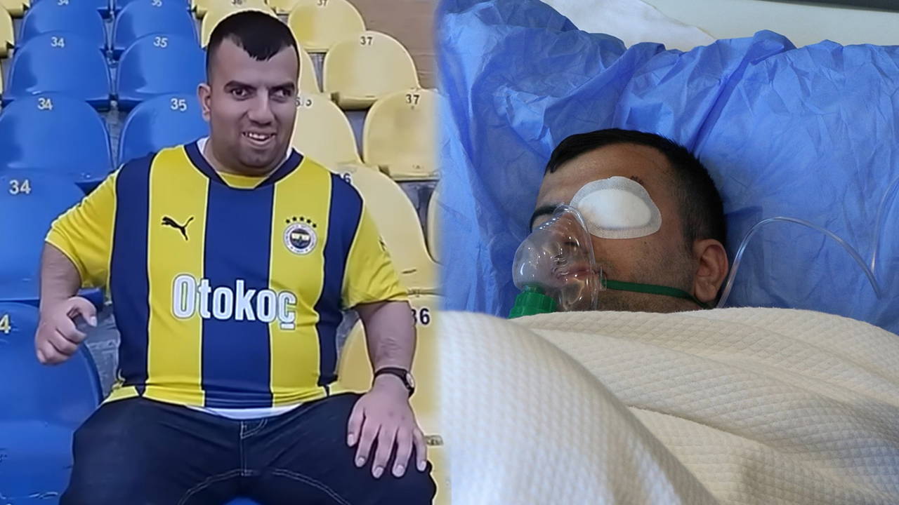 ‘Kadıköy Boğası’ lakabıyla tanınan Mustafa Başaran, göz ameliyatı oldu