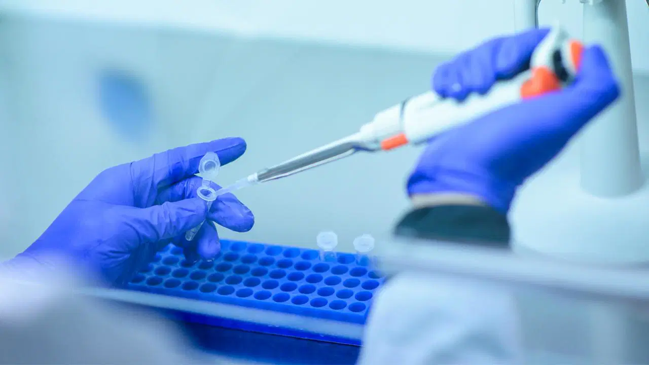 Nakledilen böbrekten kuduz bulaştı