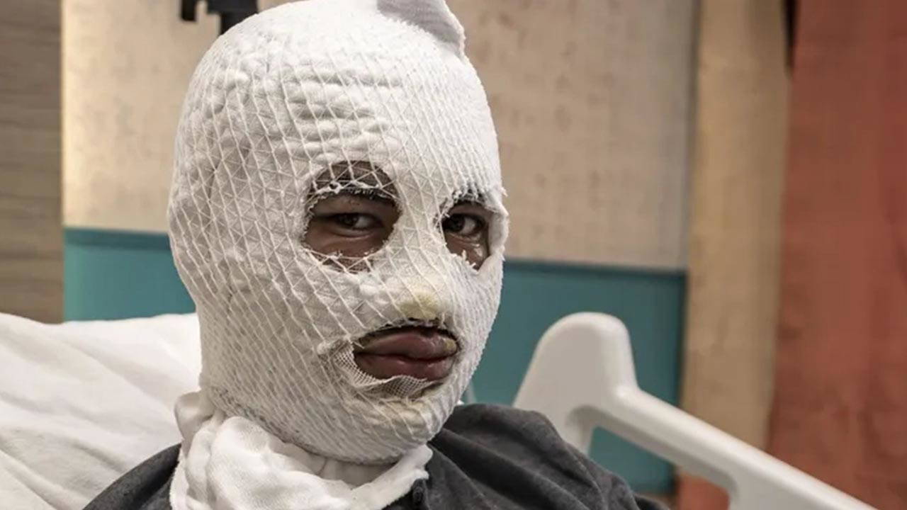 Çakmağı çaktı, hayatı karardı: Elindeki gaz tüpü bomba gibi patladı!