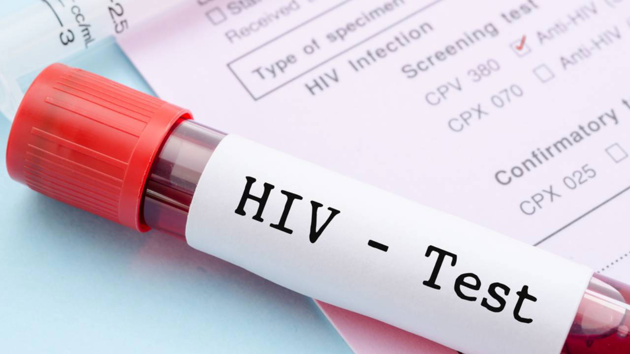 ‘HIV’de erken tanı hayat kurtarıcı’