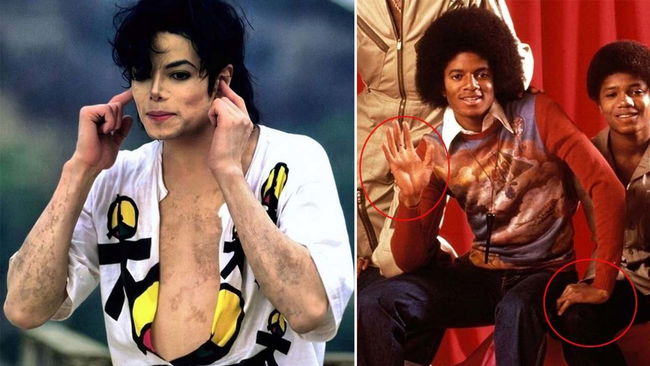 Michael Jackson'ın yeğeni: 'Amcam beyazlaşmak istemiyordu'